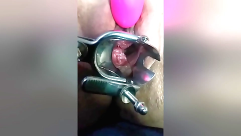 Beautiful amateur girl masturbating with her speculum